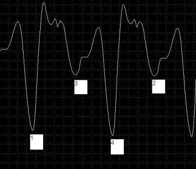 .png (57.55 КБ) 11927 просмотров .png